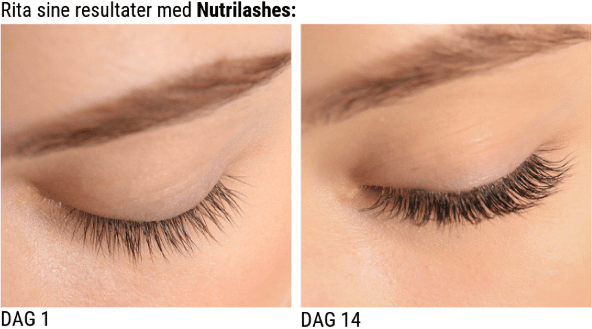 Før og etter nutrilashes
